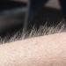 Lightening hair with hydrogen peroxide: how to make body hair invisible How to lighten hair on your arms